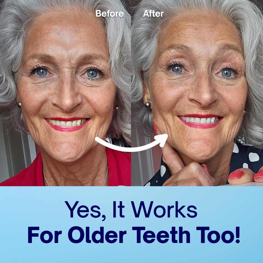 Teeth Whitening Powder